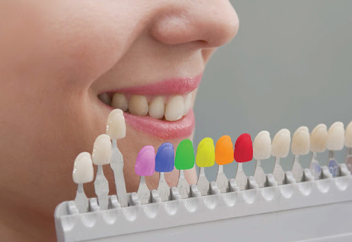 Facts About Tooth-Colored Fillings - Icard